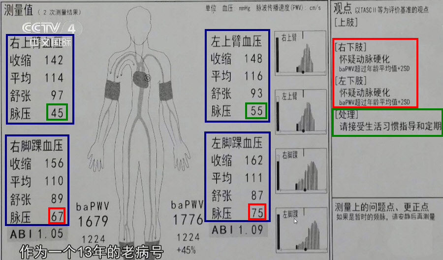分别测量四肢的血压，根据脉压差判断各自动脉血管的硬化程度(脉压差〉60提示可能有动脉粥样硬化)_01(剪切·缩放·勾注).jpg