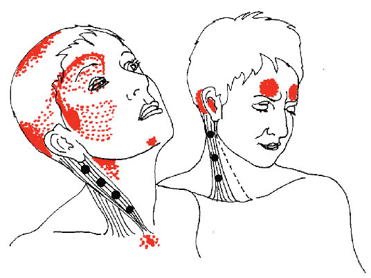 SCMTrPtspoints-drawing.jpg