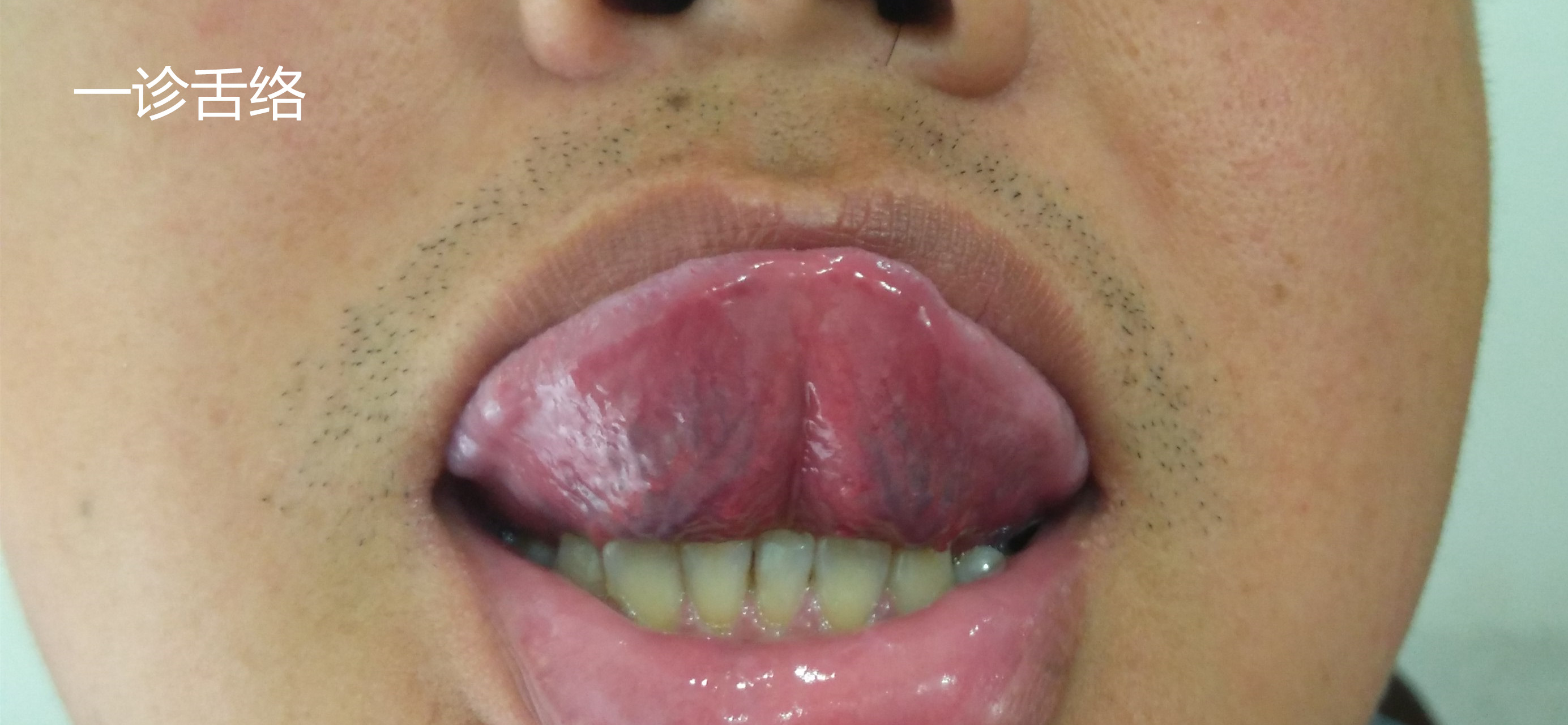 一诊舌络_副本_副本.jpg
