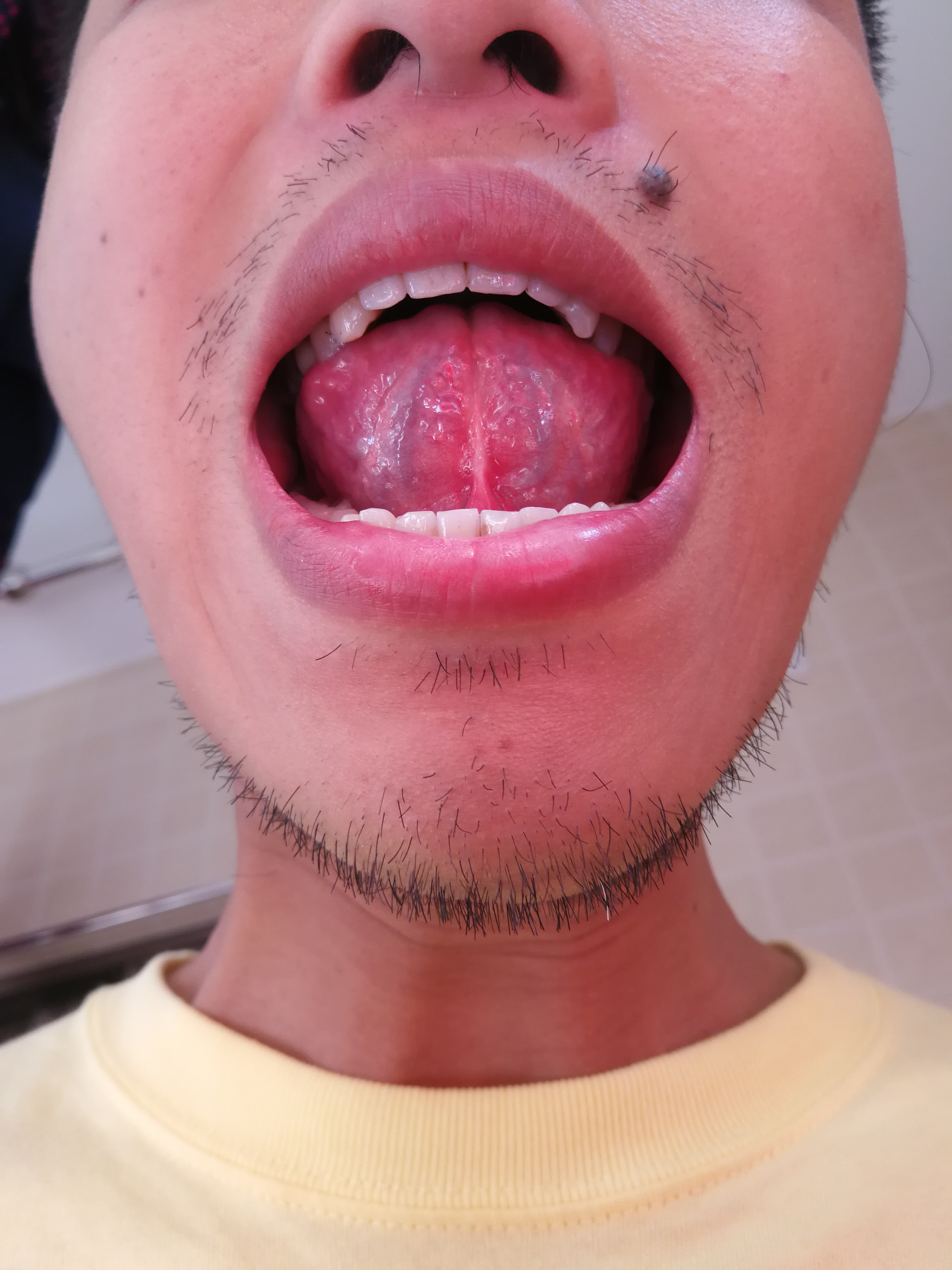 IMG_20190515_081604.jpg