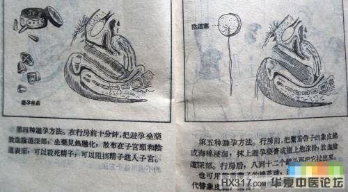 避孕.jpg