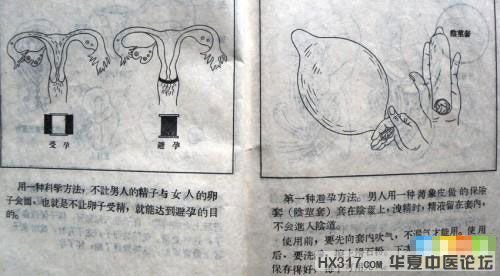 避孕2.jpg