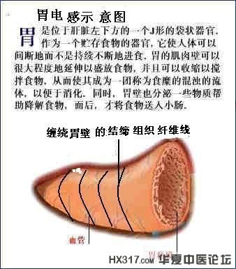 胃图.jpg