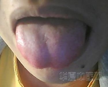 舌象.jpg