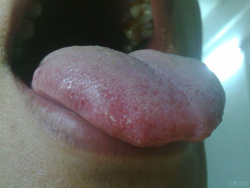 20120509194.jpg