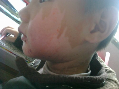 20111030489脸出院.jpg