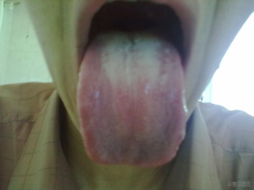20120703736.jpg