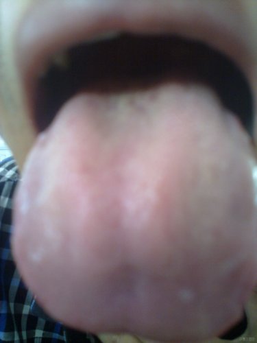 20120719635.jpg
