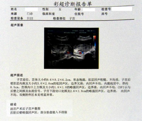 彩超单.jpg