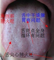 舌苔图片.jpg