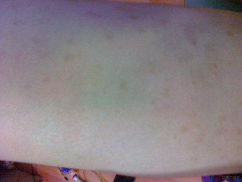 072620124660.jpg