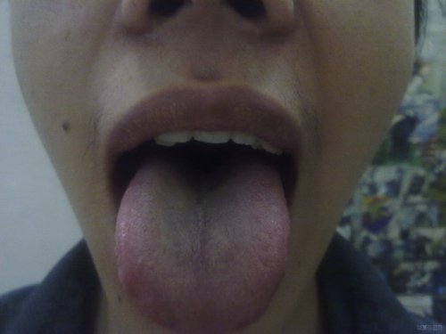 20120725656.jpg