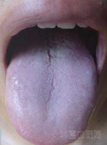 13d92d53f3deb48f33a2f04bf01f3a292cf57806.jpg