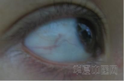 未命名1.JPG