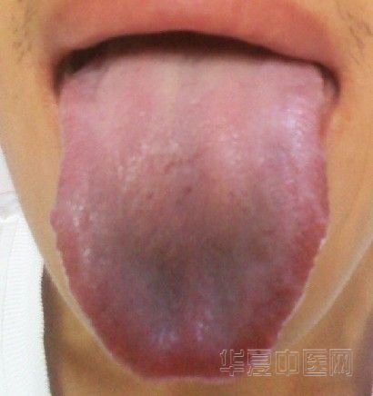 O25R]XDTRXI9}{6L([9AWBU.jpg