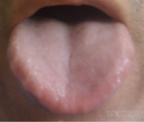 舌01.JPG