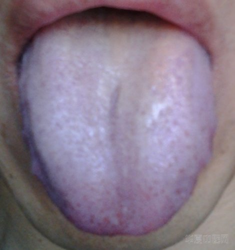 20120930_091814.jpg