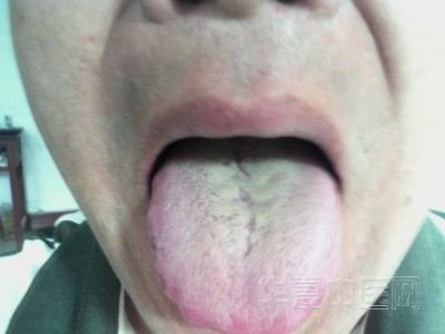 DSC_0000057_jpg_thumb.jpg