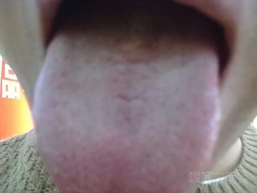 1BO[K7Y_~H$N]{2WWBZ}S30.jpg