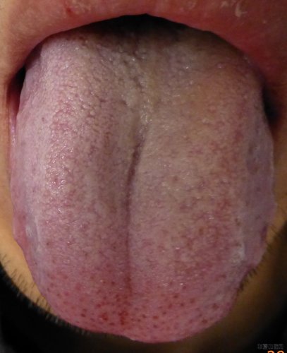 P1000066.JPG