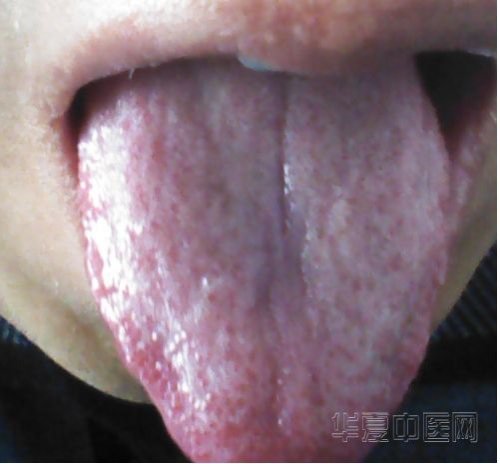 舌头1.jpg
