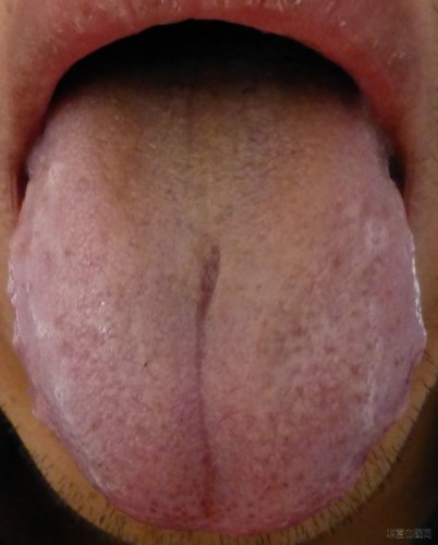 P1000105.JPG