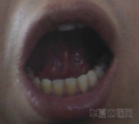 舌底1.jpg