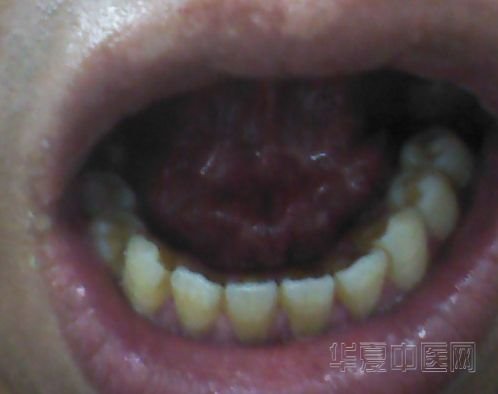 舌底2.jpg