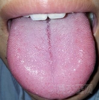 2LB]4WZY~]I(TOSA7UZ$U9B.jpg