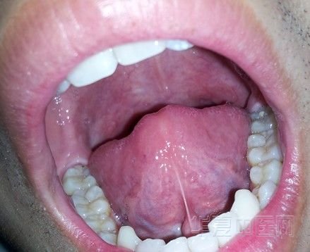 ES17I3144(HH@D)RNJW{9WK.jpg