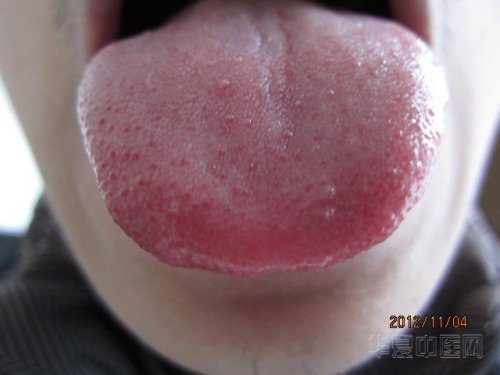 b161d0fe9925bc313dca5a615edf8db1c91370cc.jpg