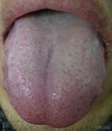 P1000147.JPG
