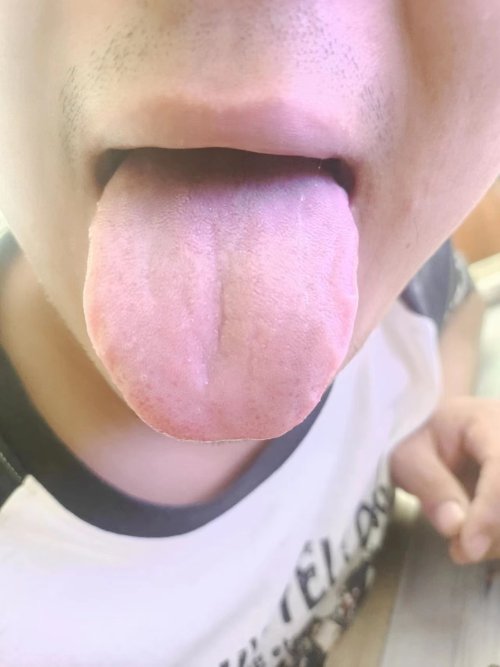 舌苔.jpg