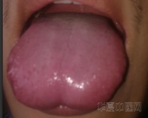 舌照1.jpg