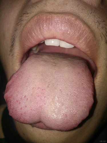 舌照3.jpg