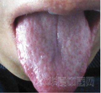 图像 5.jpg