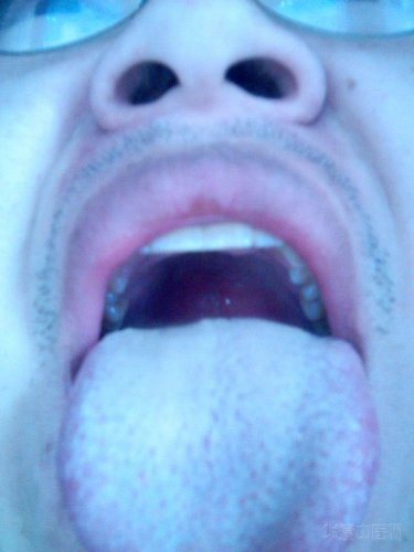 IMG_20130105_093522.jpg