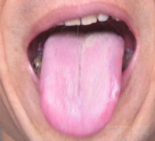 舌苔.JPG