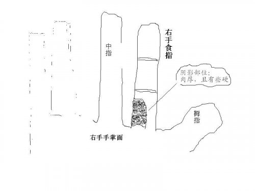 右手食指.JPG