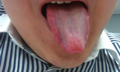 IMAG0277.jpg