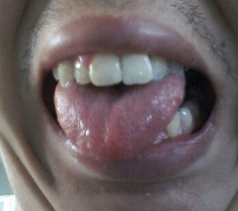 IMG20130625231212.jpg