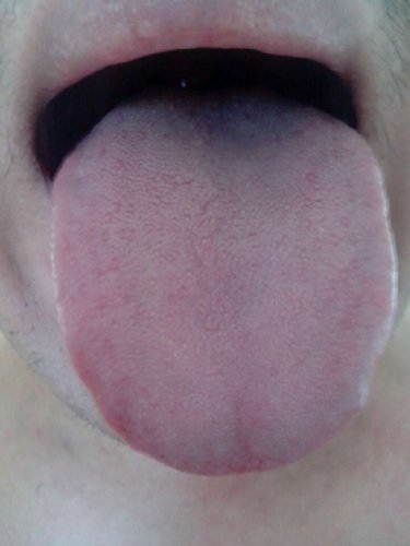 MXK204Y(HYD~LSY0LUWR6{S.jpg