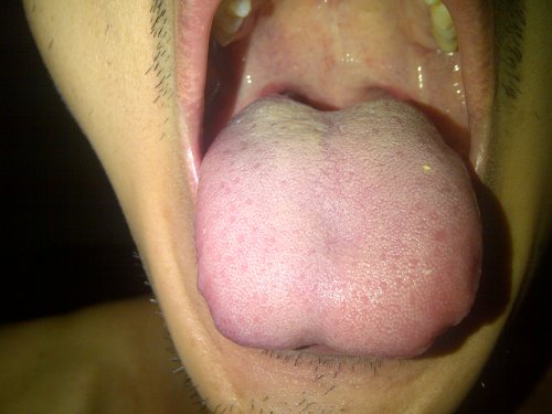 IMG-20130803-00936.jpg