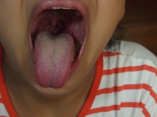 P1011001.JPG