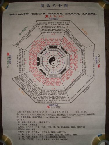 脐针八卦图.JPG