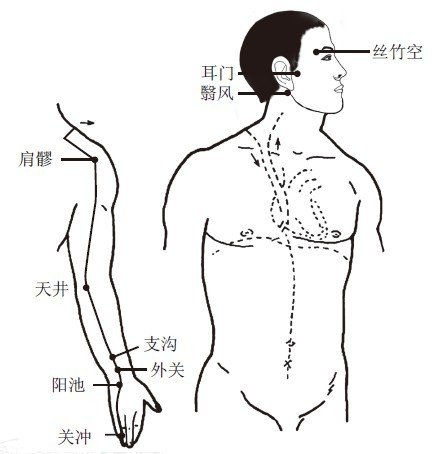 三焦经.jpg