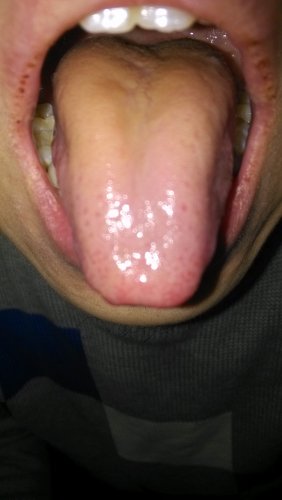 IMG_20131129_084946.jpg