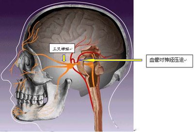 t015ada8a7b819ebcc8.jpg