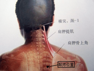 未命名1.gif