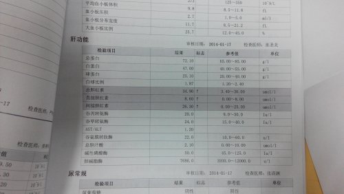 肝功能.jpg